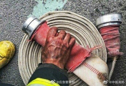 這雙手美得讓人心疼！致敬！
